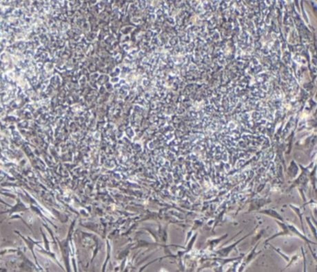 MUSE Cells: Nature’s Built-In Repair Cells