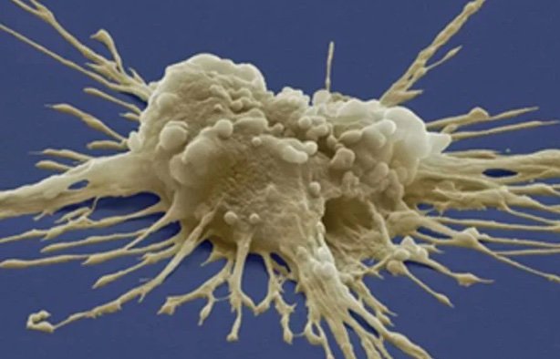 Exosomes vs. Stem Cells: Understanding the Difference