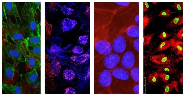 Mesenchymal Stem Cell Sources: Why Umbilical Cord–Derived MSCs Are Setting the New Standard